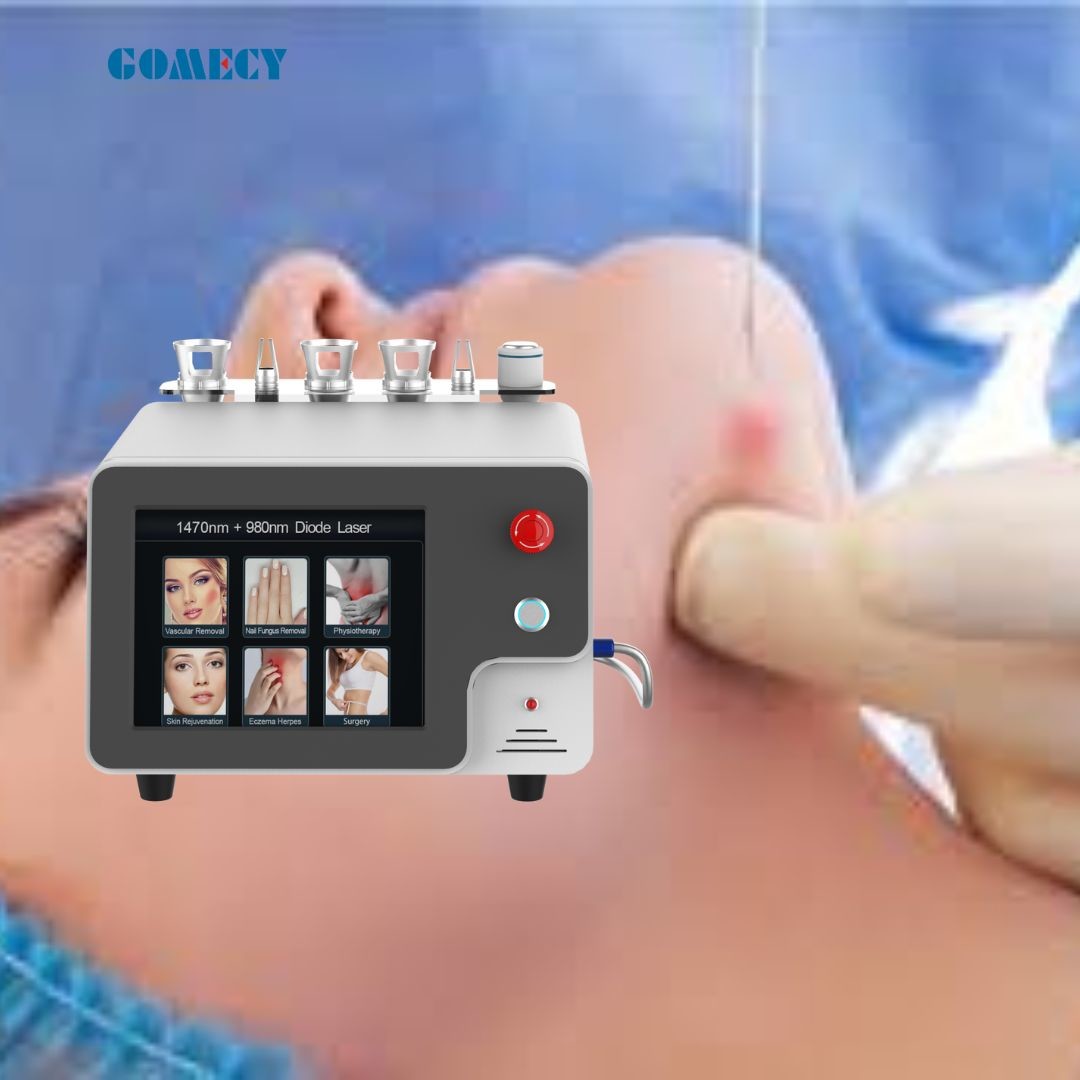 Optical Fiber Face Lifting Skin Tightening Facial 980nm 1470nm Facelift Laser Endolaser Machine