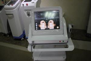 China 300W ultra age high intensity focused ultrasound hifu equipment wholesale
