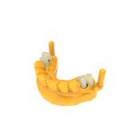 10ml Strength Permanent Crown Materials For Dental Crown Restoration