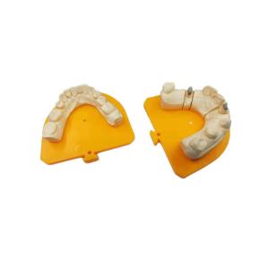 China High Strength Yellow Gold Porcelain Dental Crown PFM Ceramic Crown wholesale