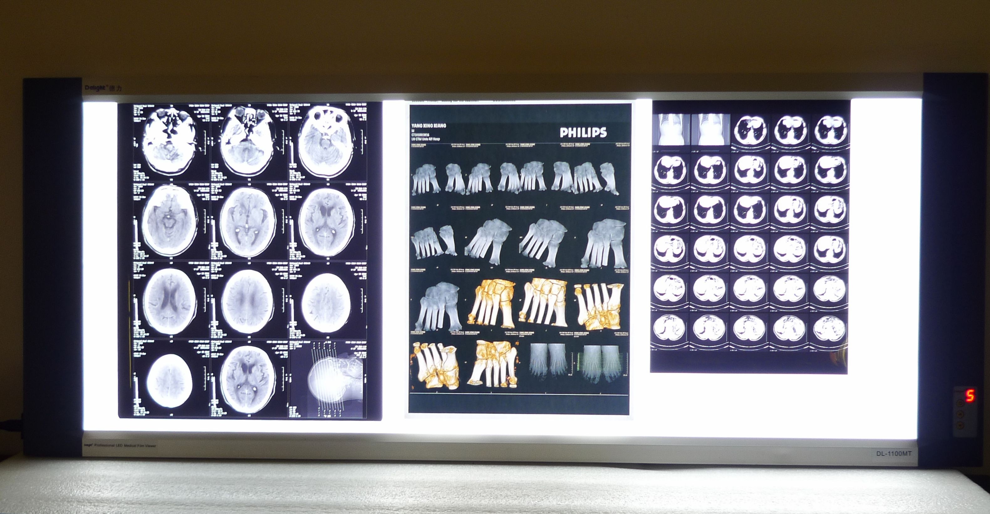 PET Medical Digital X Ray Film Stable With Agfa / Fuji Thermal Printers