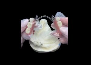 China Durable Porcelain Fused To Metal Dental Crown PFM Crown For Restoration wholesale