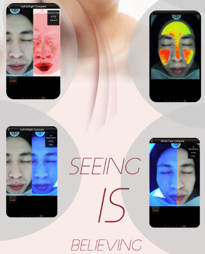 Intelligent Skin Scanner Analysis System RGB UV PL Spectrums 10.6Kg