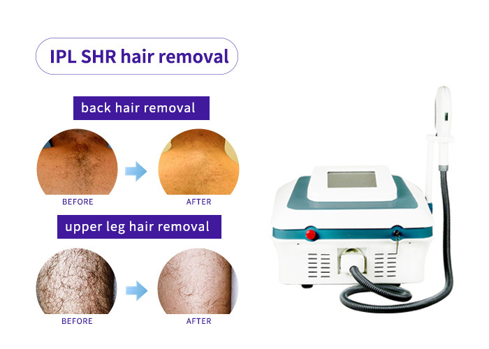 Portable Professional Ipl Hair Removal Machine , Ipl Machine For Skin Rejuvenation