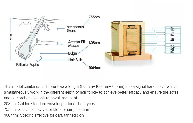 755nm 808nm 1064nm diode laser hair removal products machine/painless diode laser hair removal