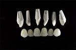 Feldspathic Porcelain Laminate Dental Veneer Seamless Customized