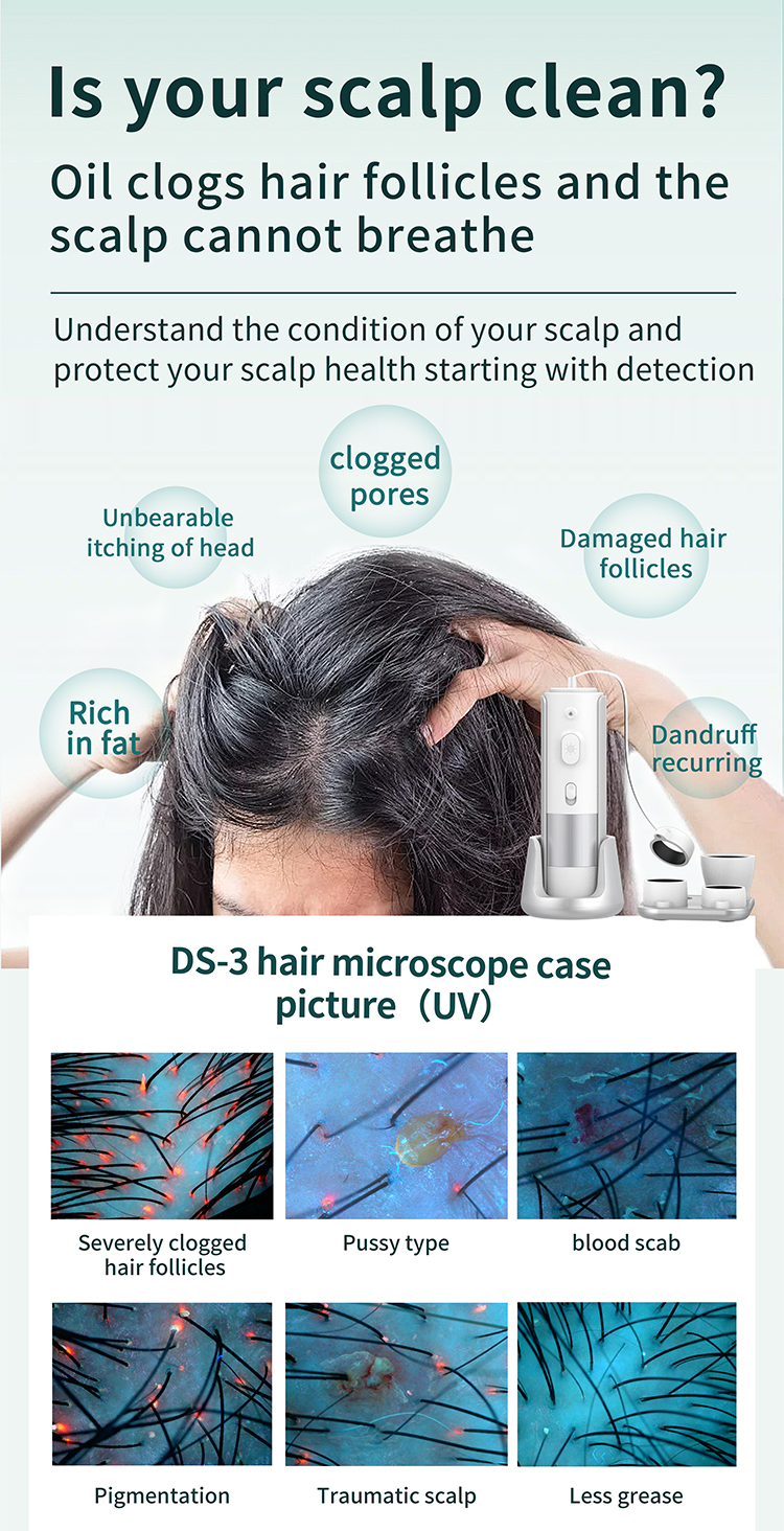 EU Plugs Type 4 In 1 Scalp Care Machine Multi Language For Hair Oiliness Analysis