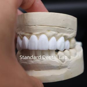 China Dental crowns diagnostic wax-up High Esthetics From China Dental Lab wholesale