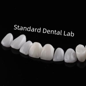 China High Esthetic Teeth Emax Laminate Veneers Incisal Translucency wholesale