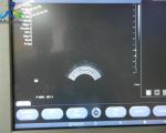 Siemens EC9-4 Endocavity Ultrasound Probe X300 System Medical
