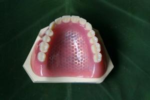 China ISO13485 Conventional Denture Upper Acrylic Partial wholesale