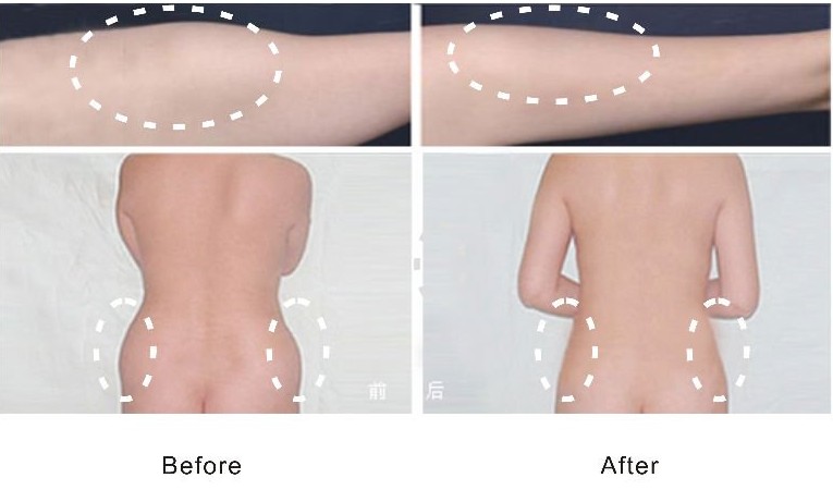 12 paddles i lipo laser/dual wavelength lipolaser slimming machine
