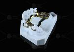 Corrosion Resistant Printed Titanium Framework Sensitive Skin