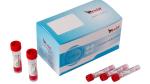 Room Temperature Storage Non-Additive Vacuum Blood Collection Tubes With