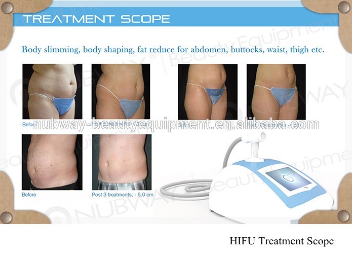 Portable HIFU slimming machine Treatment Scope.jpg