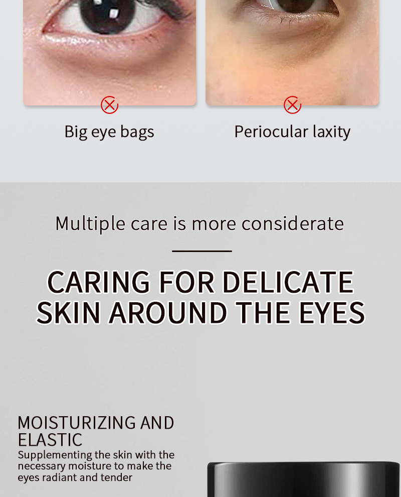 Firming And Moisturizing Reducing Fine Lines Dark Circles And Bag Removal Eye Dark Circles Remove Cream