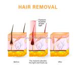 Rechargeable VCA IPL Hair Removal Machine 808nm Ellipse IPL Machine