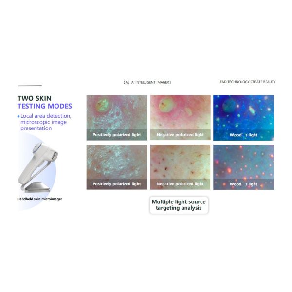 15 Types Detection Indicators Skin Analyzer Facial Diagnostic Skin Moisture Test Facial Analysis 3d Skin Analysis Machine