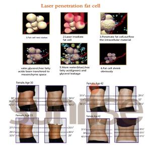 China Beijing sunrise CE No Pain Diode Lipo Laser / Lipolaser Fat Removal treatment wholesale