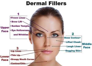 China CE Approved Injectable Facial Hyaluronic Acid, Hyaluronic Acid Dermal Filler Injection, Cr wholesale