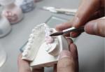 High Strength Dental Base Metal Alloys Wear Proof Dental Casting Alloys