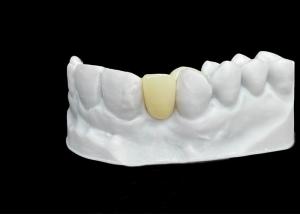 China Chipping Resistance Zirconia dental Crown With Exceptional Strength And Translucency wholesale