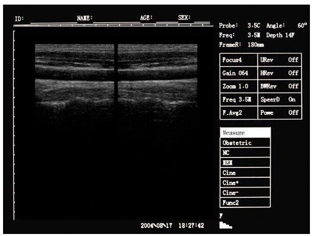 Portable ultrasound machine Laptop Ultrasound machine SU-7S with CE