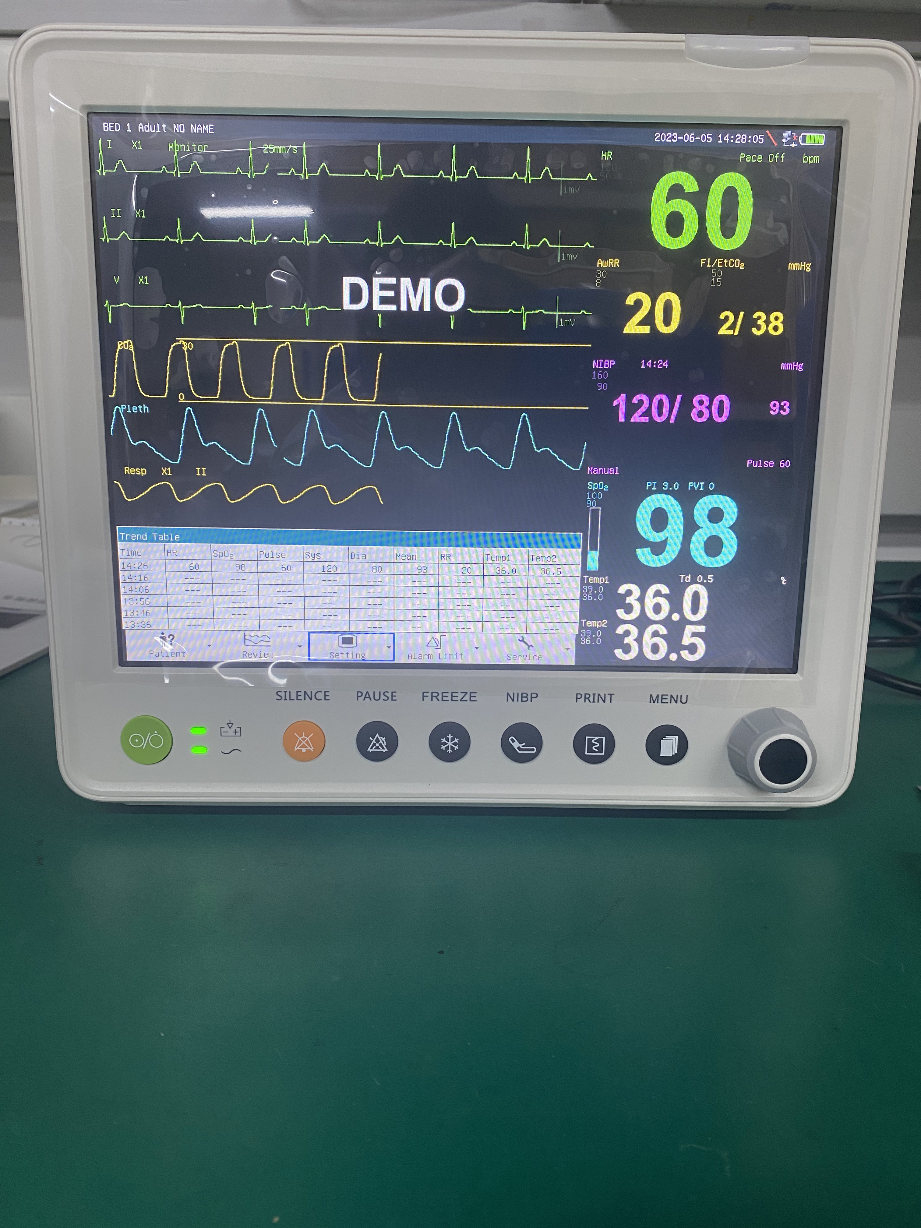 Portable Patient Monitor With Parameters Of ETCO2 ECG NIBP SPO2 RESP TEMP PR