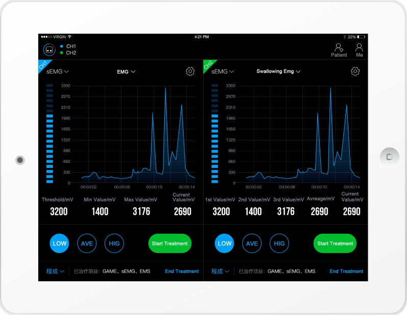 Functional Electrical SEMG Biofeedback Equipment For Nerve And Muscle Stimulation