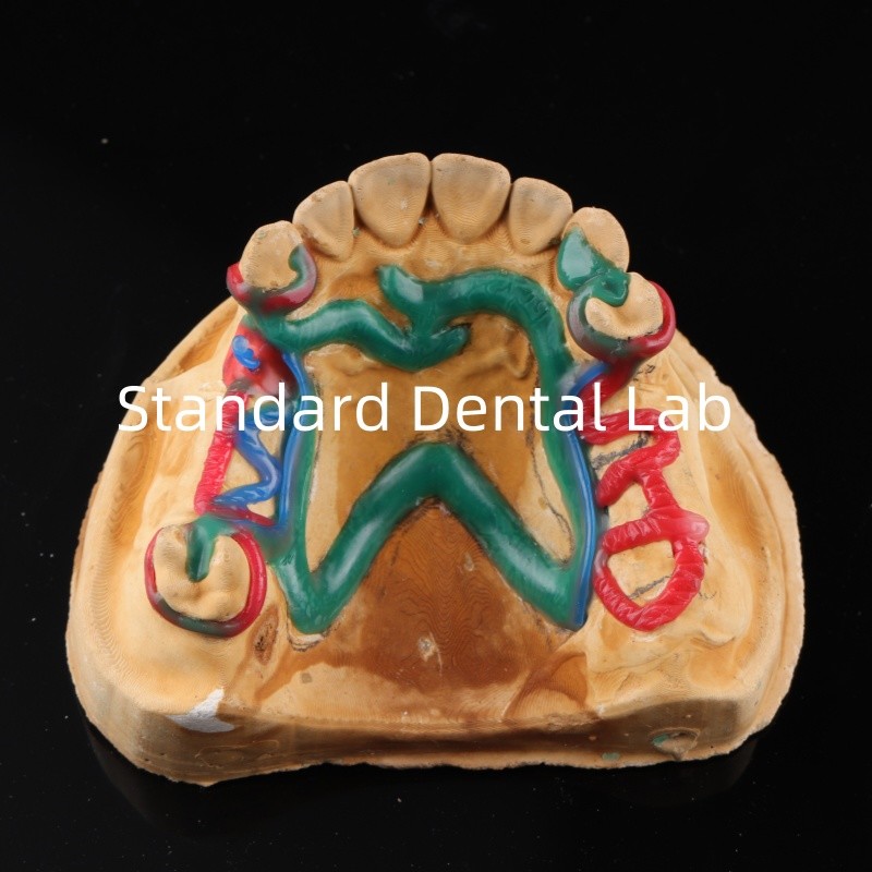 Cobalt Chrome Framework Ni Be Free removable dental prosthesis China Dental Lab