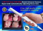HK710 Intraoral Dental Camera