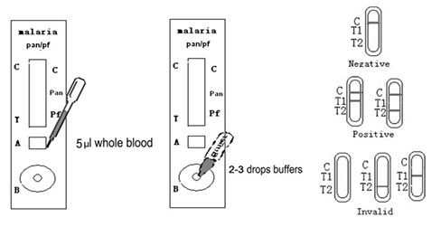 One Step Malaria pan/ pf Antigen Detection Test Device Whole Blood Colloidal Gold Rapid Test
