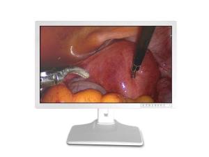 China Medical Endoscopic Accessories Display 32inch wholesale