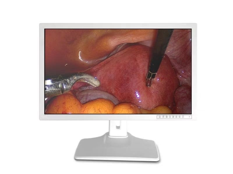 DVI-I VGA CVBS Endoscopic Accessories Medical Monitor 24inch
