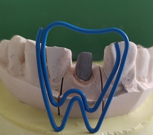 ISO13485 Pivot Core Dental Post And Core For Fracture Tooth