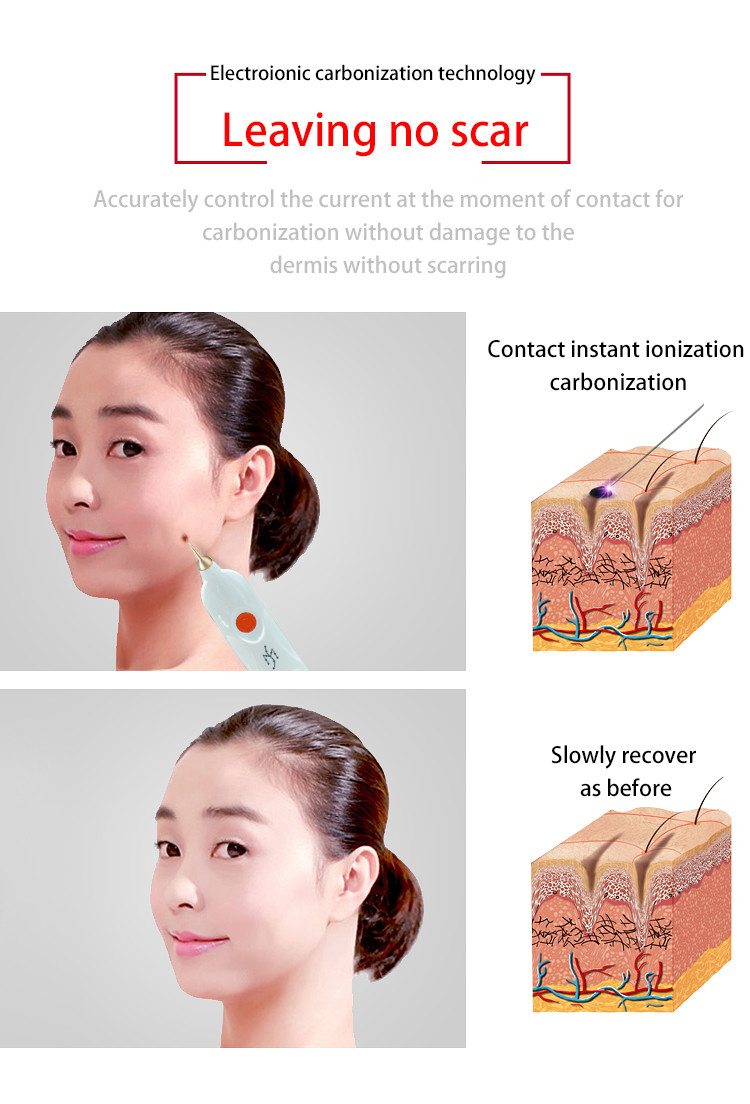 Plasma Eyelid Lifting Beauty Skin Rejuvenation Machine 220V For Wart Nevus Removal