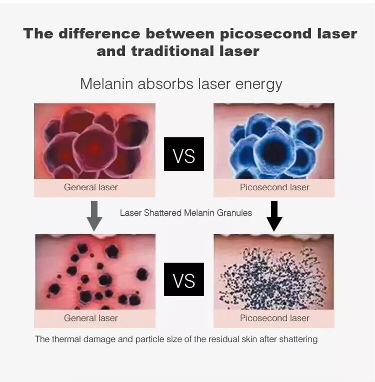 1-10HZ Picosecond Laser Machine 532nm 755nm 1064nm 1320nm With Treatment Tips