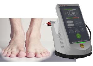 China 10W Laser Treatment Machine Toenail Fungus Wart Removal Laser Treatment wholesale
