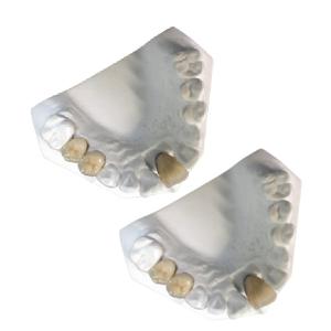 China Good Mechanical Porcelain Metal Crowns Yellow Gold High Strength wholesale