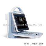Medical Equipment portable Ultrasound machine ultrasound oem color diagnostic