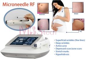 China Stretch Marks Removal Face Lifting Rf Microneedle Machine wholesale