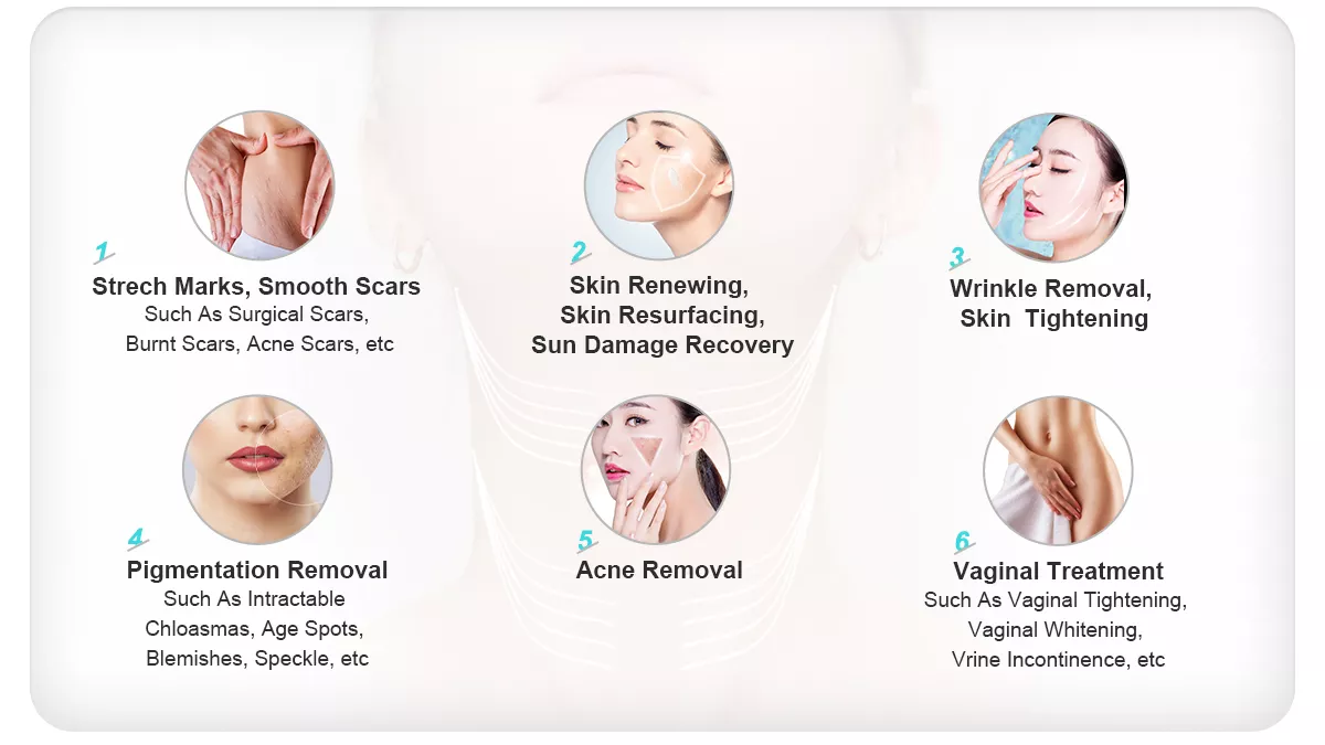 40W RF Metal Tube CO2 Fractional Laser Fractional CO2 Laser Machine For Scars Skin Resurfacing Vaginal Tightening