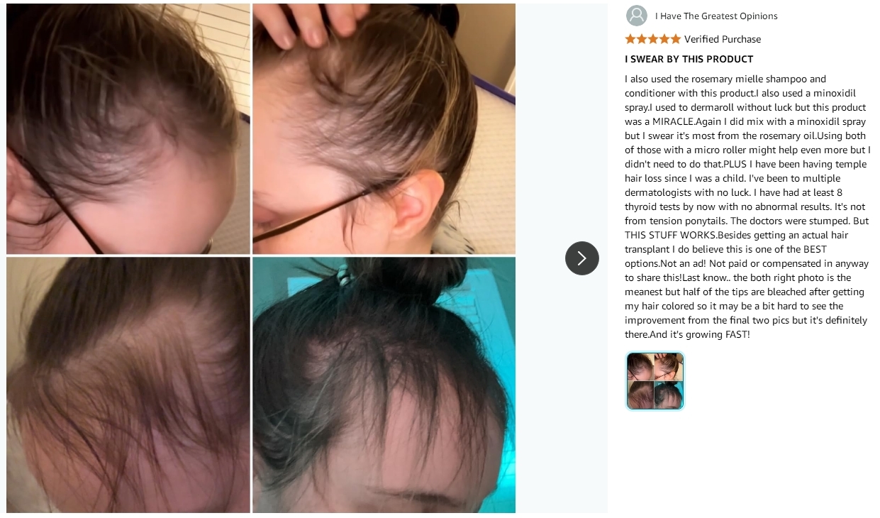 Scalp Treatment Rosemary Mint Argan Oil Hair Strengthening 2Oz