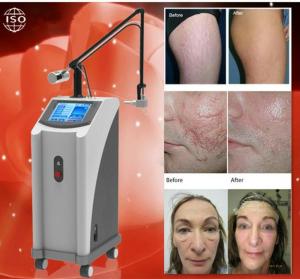 China FDA approved Medical beauty equipment 30W vaginal tightening Fractional CO2 Laser Equipment / CO2 Fractional laser machi wholesale