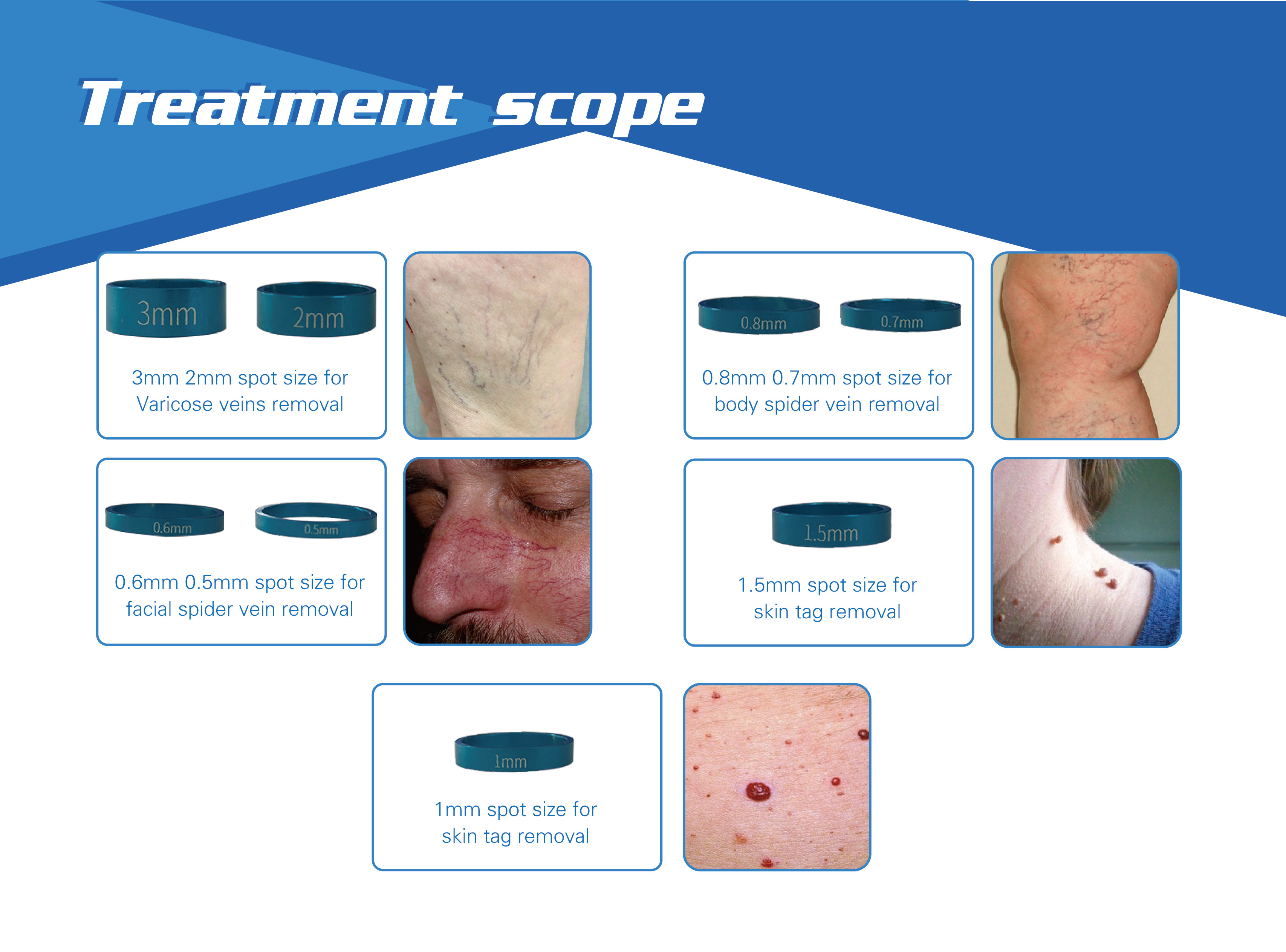 vein removal laser 980nm spider vein removal machine vascular remover