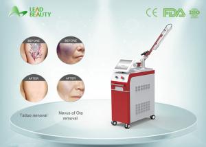China High technical q switch nd yag laser tattoo removal machine wholesale