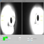 SD Optical Coherence Tomography Machine Noninvasive Ophthalmic Imaging