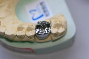 China Full Cast Base Metal Alloys Dental Crown wholesale