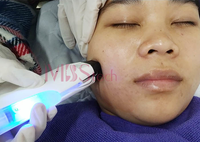 Skin Rejuvenation Face Lifting Thermagic Microneedle RF Machine