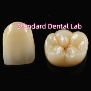 China Biocompatible Material Aesthetic Zirconia Crown Zirconia Bridge Teeth wholesale